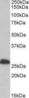 Electron transfer flavoprotein subunit beta antibody, NBP1-49843, Novus Biologicals, Western Blot image 