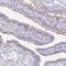 Chromosome 20 Open Reading Frame 85 antibody, NBP2-49451, Novus Biologicals, Immunohistochemistry frozen image 