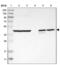 Chromosome 1 Open Reading Frame 159 antibody, NBP1-93971, Novus Biologicals, Western Blot image 