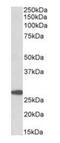 Prostaglandin-H2 D-isomerase antibody, orb154572, Biorbyt, Western Blot image 