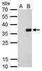 S-tag epitope tag antibody, NBP2-43817, Novus Biologicals, Western Blot image 