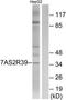 Taste 2 Receptor Member 39 antibody, TA316278, Origene, Western Blot image 