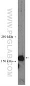 CD11b antibody, 20991-1-AP, Proteintech Group, Western Blot image 