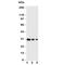 Thyroid Stimulating Hormone Receptor antibody, R31120, NSJ Bioreagents, Western Blot image 