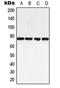 Bruton Tyrosine Kinase antibody, MBS8234916, MyBioSource, Western Blot image 
