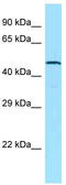 Adhesion G Protein-Coupled Receptor A1 antibody, TA342756, Origene, Western Blot image 
