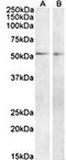 Vasoactive Intestinal Peptide Receptor 1 antibody, orb125181, Biorbyt, Western Blot image 