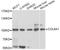 Collagen alpha-1(IX) chain antibody, A10851, ABclonal Technology, Western Blot image 
