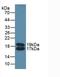 Apolipoprotein C4 antibody, LS-C314832, Lifespan Biosciences, Western Blot image 