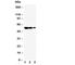 FAS antibody, R30285, NSJ Bioreagents, Western Blot image 
