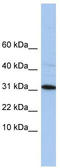 Chromosome 9 Open Reading Frame 153 antibody, TA334930, Origene, Western Blot image 