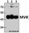 Mevalonate Kinase antibody, A02465, Boster Biological Technology, Western Blot image 
