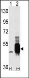 Mitogen-activated protein kinase kinase kinase 8 antibody, AP14782PU-N, Origene, Western Blot image 