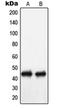 Potassium Voltage-Gated Channel Subfamily H Member 2 antibody, orb340858, Biorbyt, Western Blot image 