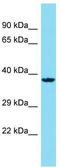 Clathrin Binding Box Of Aftiphilin Containing 1 antibody, TA333453, Origene, Western Blot image 