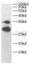 TP53 Induced Glycolysis Regulatory Phosphatase antibody, FNab10370, FineTest, Western Blot image 