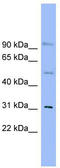 Solute Carrier Family 25 Member 25 antibody, TA334151, Origene, Western Blot image 
