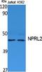 NPR2 Like, GATOR1 Complex Subunit antibody, A06286, Boster Biological Technology, Western Blot image 
