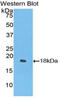 Interferon Gamma antibody, LS-C294753, Lifespan Biosciences, Western Blot image 