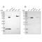 Carnitine O-Acetyltransferase antibody, NBP1-86615, Novus Biologicals, Western Blot image 