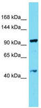 Dynein Regulatory Complex Subunit 7 antibody, TA331695, Origene, Western Blot image 