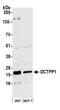 DCTP Pyrophosphatase 1 antibody, A305-794A-M, Bethyl Labs, Western Blot image 