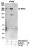 Neuroblastoma-amplified sequence antibody, A305-636A-M, Bethyl Labs, Immunoprecipitation image 