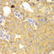 Receptor For Activated C Kinase 1 antibody, LS-C746714, Lifespan Biosciences, Immunohistochemistry paraffin image 