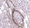 Amyloid P Component, Serum antibody, PA5-78788, Invitrogen Antibodies, Immunohistochemistry frozen image 