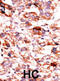 AarF Domain Containing Kinase 5 antibody, abx033183, Abbexa, Immunohistochemistry paraffin image 