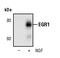 Early Growth Response 1 antibody, MA5-15009, Invitrogen Antibodies, Western Blot image 