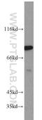 PCIF1 antibody, 16082-1-AP, Proteintech Group, Western Blot image 