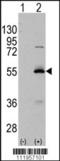 Aldehyde Dehydrogenase 6 Family Member A1 antibody, TA302121, Origene, Western Blot image 