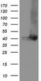 Tubulin Folding Cofactor C antibody, CF504758, Origene, Western Blot image 
