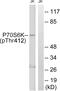 Ribosomal Protein S6 Kinase B1 antibody, OAAF07416, Aviva Systems Biology, Western Blot image 