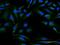 DnaJ Heat Shock Protein Family (Hsp40) Member C30 antibody, H00084277-B01P, Novus Biologicals, Immunocytochemistry image 