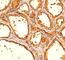 Thyroglobulin antibody, V2263SAF-100UG, NSJ Bioreagents, Immunohistochemistry frozen image 