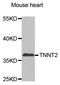 Troponin T2, Cardiac Type antibody, STJ110339, St John