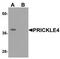 Prickle Planar Cell Polarity Protein 4 antibody, TA319905, Origene, Western Blot image 