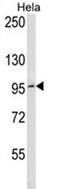 BCL6 Transcription Repressor antibody, AP50359PU-N, Origene, Western Blot image 