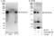 Zinc Finger CCHC-Type Containing 14 antibody, A303-096A, Bethyl Labs, Western Blot image 