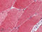 Heat shock factor protein 1 antibody, ADI-SPA-950-F, Enzo Life Sciences, Immunohistochemistry paraffin image 
