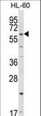 CYP51A1 antibody, LS-C167242, Lifespan Biosciences, Western Blot image 