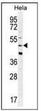 Corticotropin Releasing Hormone Receptor 2 antibody, AP51080PU-N, Origene, Western Blot image 