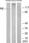 RB Transcriptional Corepressor 1 antibody, LS-C118237, Lifespan Biosciences, Western Blot image 