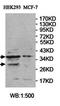 Polyhomeotic-like protein 2 antibody, orb78026, Biorbyt, Western Blot image 