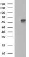 Alkaline Phosphatase, Placental antibody, LS-C338098, Lifespan Biosciences, Western Blot image 