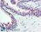 STEAP2 Metalloreductase antibody, LS-A9242, Lifespan Biosciences, Immunohistochemistry paraffin image 