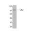Salt Inducible Kinase 2 antibody, LS-B1898, Lifespan Biosciences, Western Blot image 