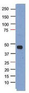 PHD Finger Protein 6 antibody, TA339156, Origene, Western Blot image 